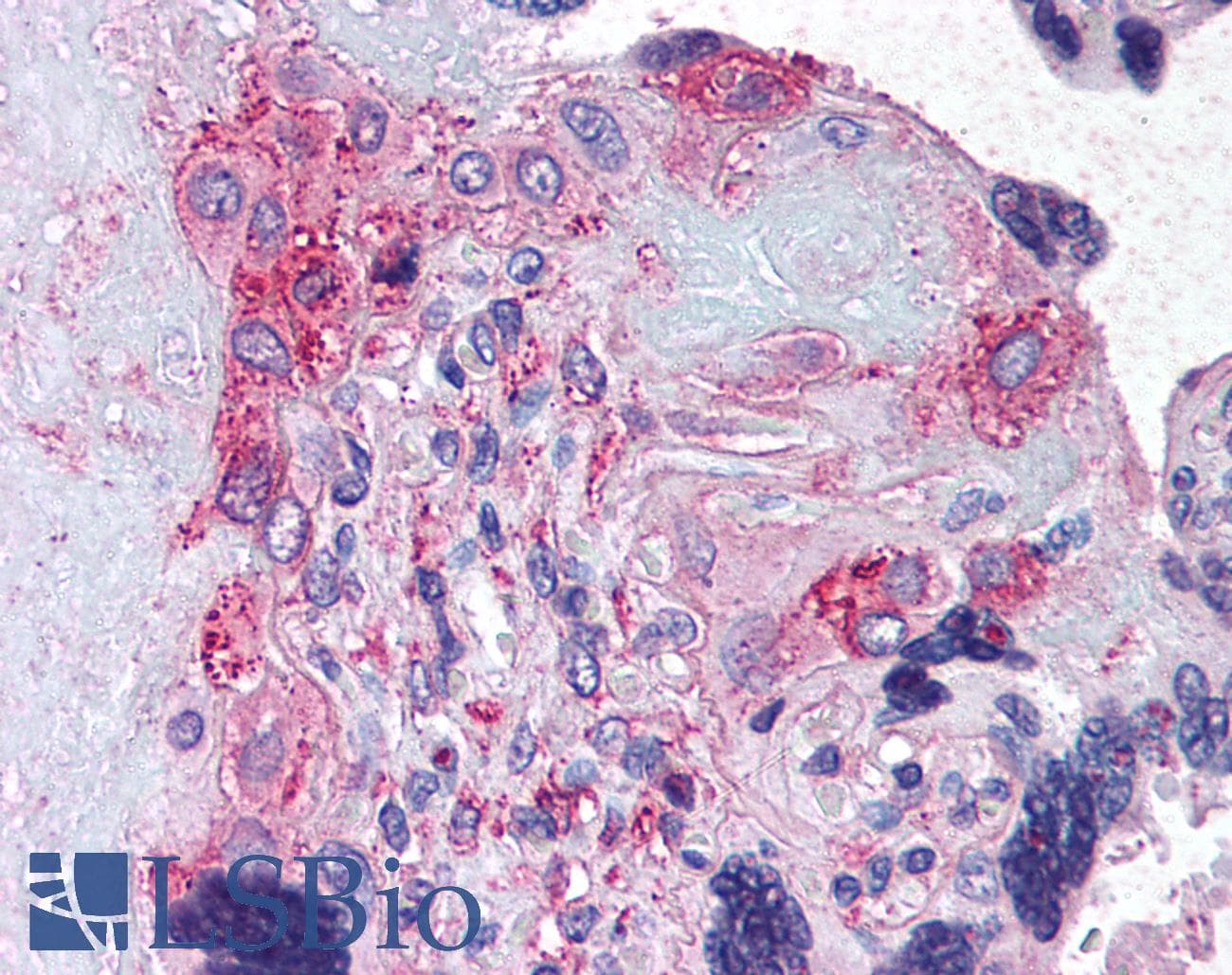 IHC-plus™ ADAMTS5 Antibody (Internal)