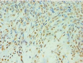 Polyclonal Rabbit anti-Human TDP1 Antibody (aa1-260, IHC, WB)