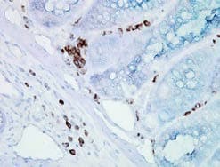 HSP70/73 Antibody (clone BB70)