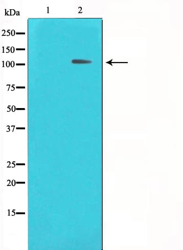 Polyclonal Rabbit anti-Human HDAC7 Antibody (IHC, IF, WB)