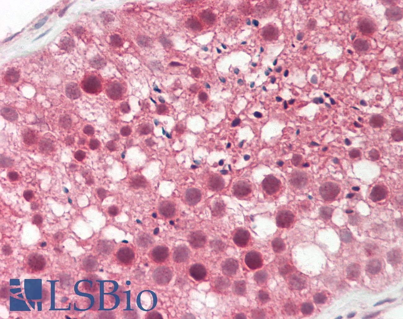 PathPlus™ Polyclonal Rabbit anti-Human ALK2 / ACVR1 Antibody (aa138-170, IHC, WB)