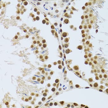MTA3 Antibody