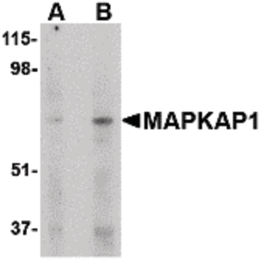 IHC-plus™ Polyclonal Rabbit anti-Human MAPKAP1 / MIP1 Antibody (IHC, WB)