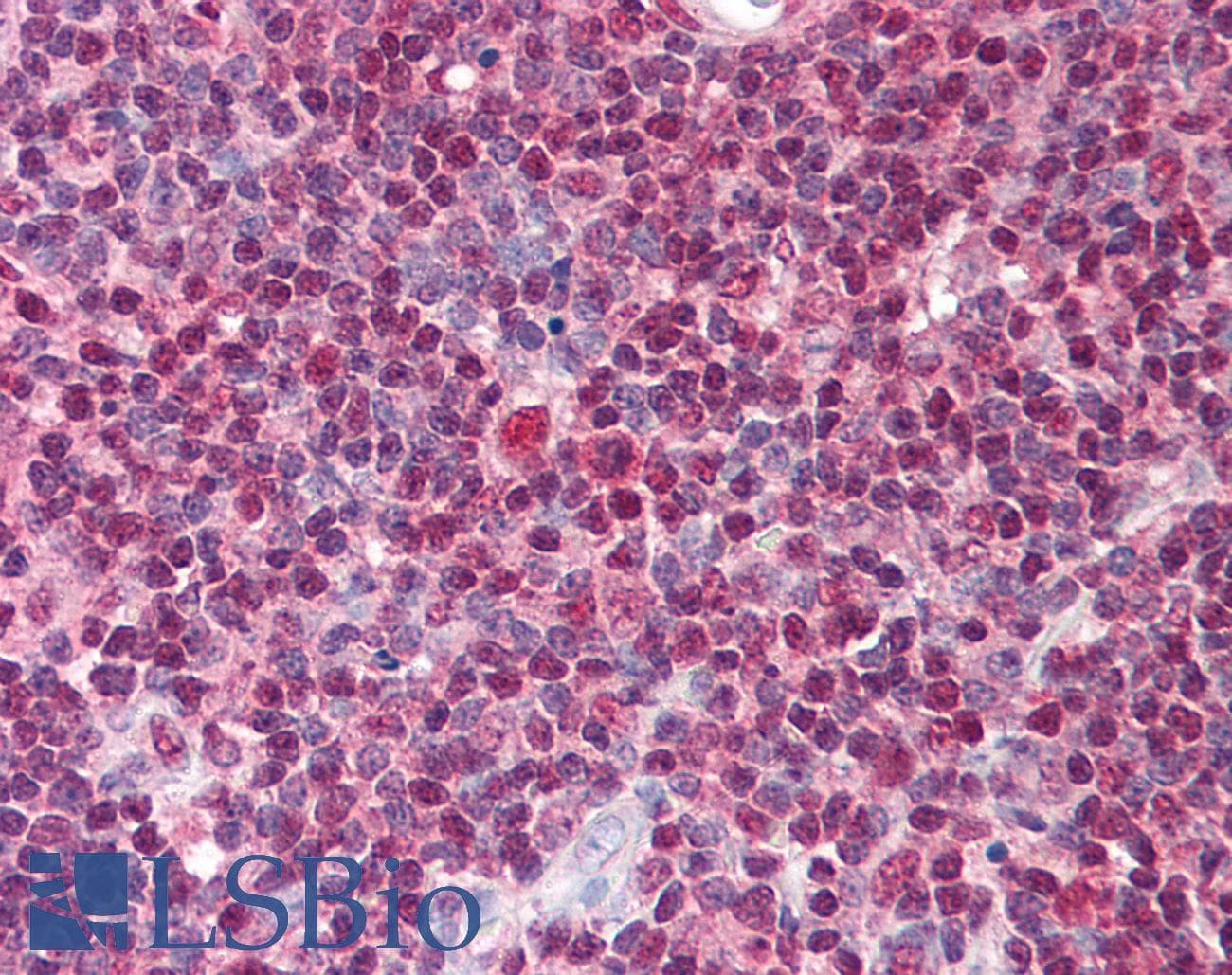 IHC-plus™ TSLP Antibody