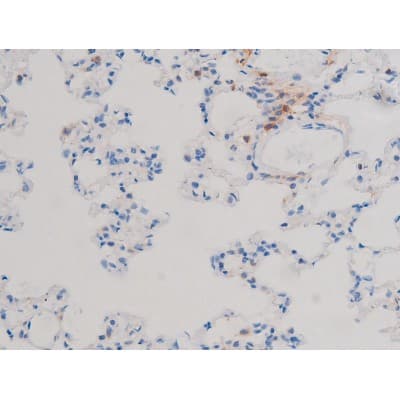 Polyclonal Rabbit anti-Human CDC25A Antibody (phospho-Ser124, IHC, IF, WB)