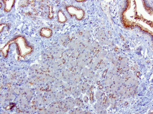 Monoclonal Mouse anti-Human SQSTM1 Antibody (clone UMAB12, Carrier-free, IHC, IF, WB)