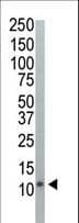 IHC-plus™ UBC / Ubiquitin C Antibody (aa36-66)