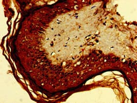 Polyclonal Rabbit anti-Human NKG2DL4 / ULBP4 Antibody (IHC)