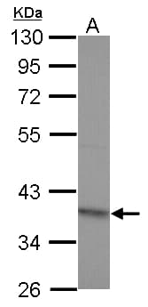 RG9MTD2 Antibody