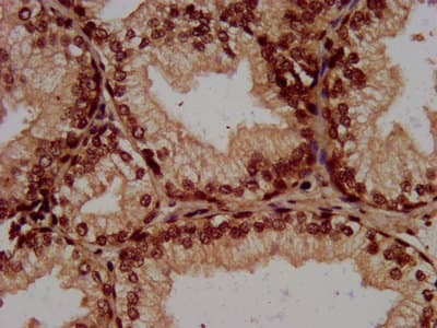 Polyclonal Rabbit anti-Human HIST1H3A Antibody (IHC)
