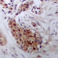 Polyclonal Rabbit anti-Human STAT4 Antibody (C-Terminus, IHC, WB)