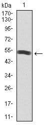 Monoclonal Mouse anti-Human PIK3R1 / p85 Alpha Antibody (clone 6G10, Amino Acid: 159-388, IHC, IF, WB)