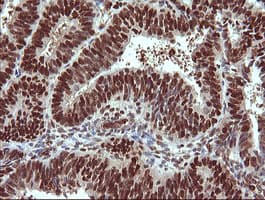 TRIM38 Antibody (clone OTI113D3)