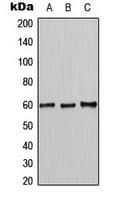 Polyclonal Rabbit anti-Human MUTYH / MYH Antibody (Internal, IHC, IF, WB)