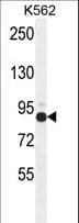 Polyclonal Rabbit anti-Human ZNF366 Antibody (aa650-678, WB)
