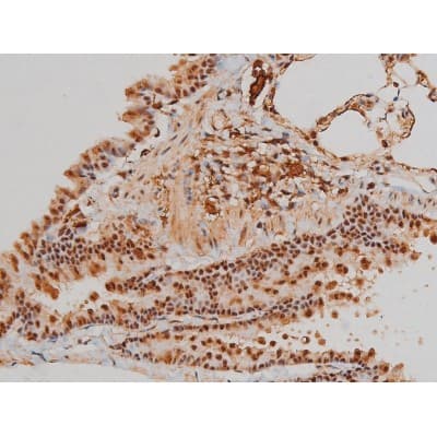 Polyclonal Rabbit anti-Human FLNA / Filamin A Antibody (phospho-Ser2152, IHC, IF, WB)