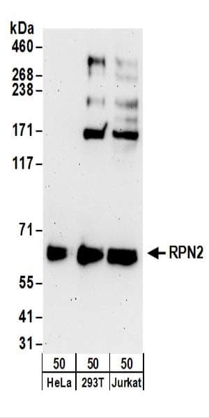 RPN2 / Ribophorin II Antibody (aa350-400)