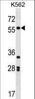 SOX11 Antibody (aa103-132)
