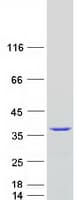 Human SNRPA / U1A Protein (Recombinant Myc-DDK (Flag))
