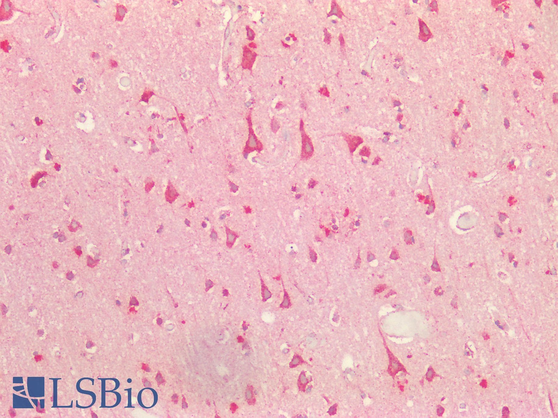 Polyclonal Rabbit anti-Human S100 Protein Antibody (IHC, IF, WB)