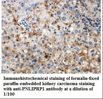 Polyclonal Rabbit anti-Human PNLIPRP1 Antibody (aa207-385, IHC, WB)