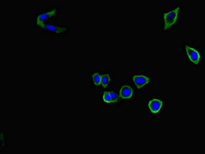 Complement C9 Antibody