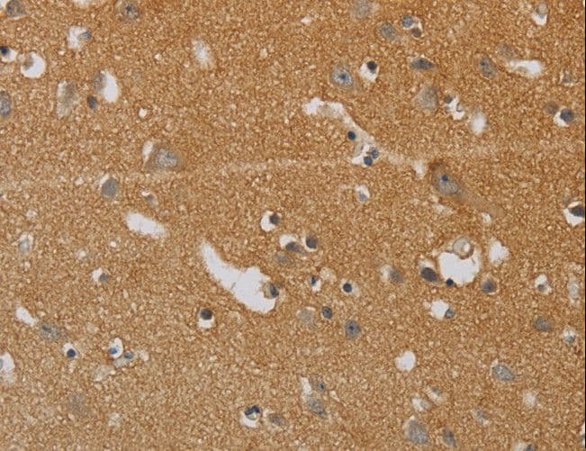 KIF4A Antibody
