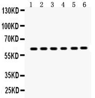 SLC1A2 / EAAT2 / GLT-1 Antibody (aa461-574)