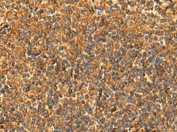 Polyclonal Rabbit anti-Human HS1BP3 Antibody (IHC)