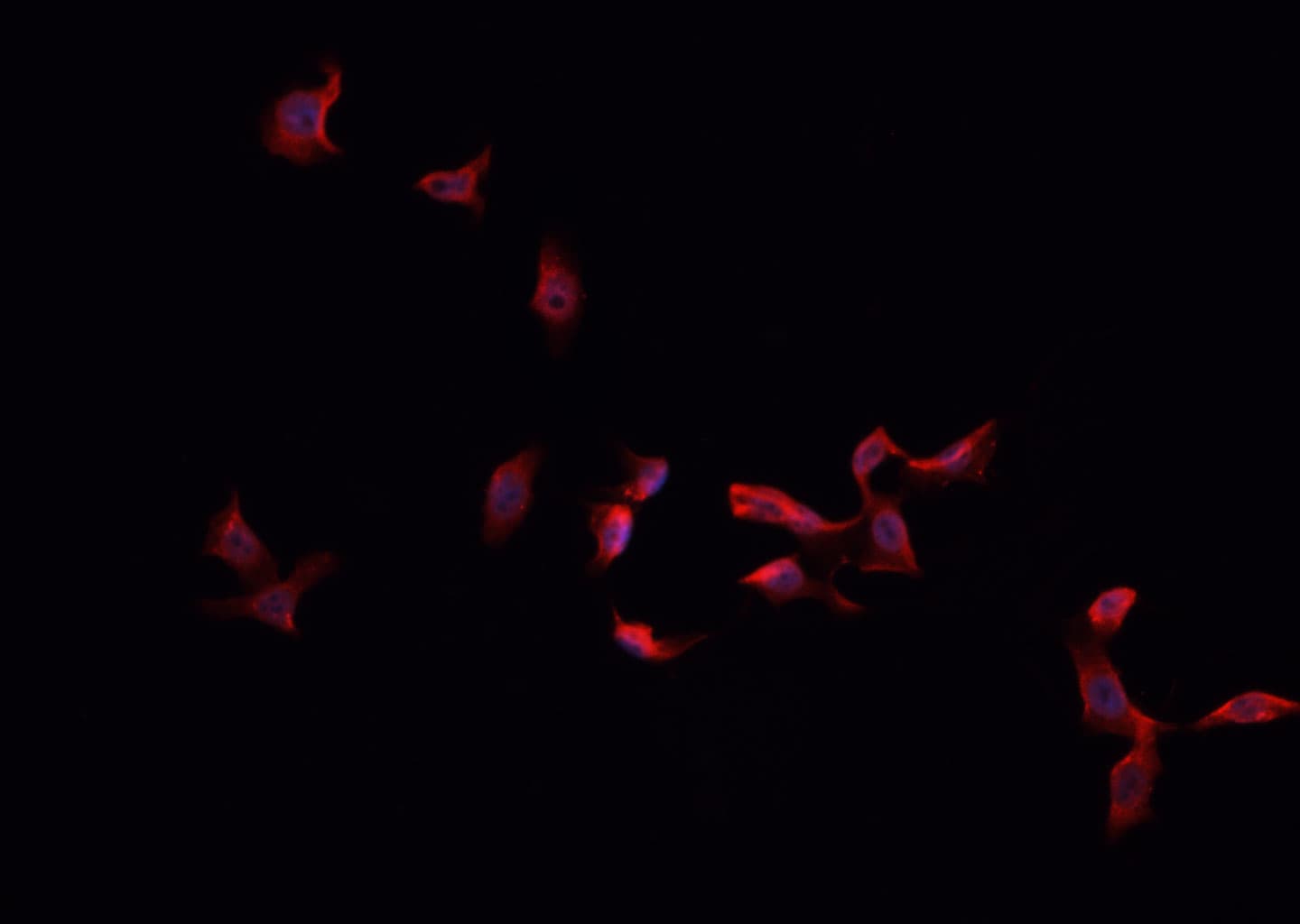 Polyclonal Rabbit anti-Human S100A1 / S100-A1 Antibody (IHC, IF, WB)