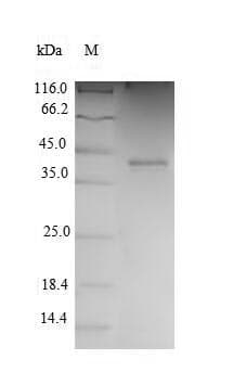 Human CDK2 Protein (Recombinant 6His-T7, N-terminus)