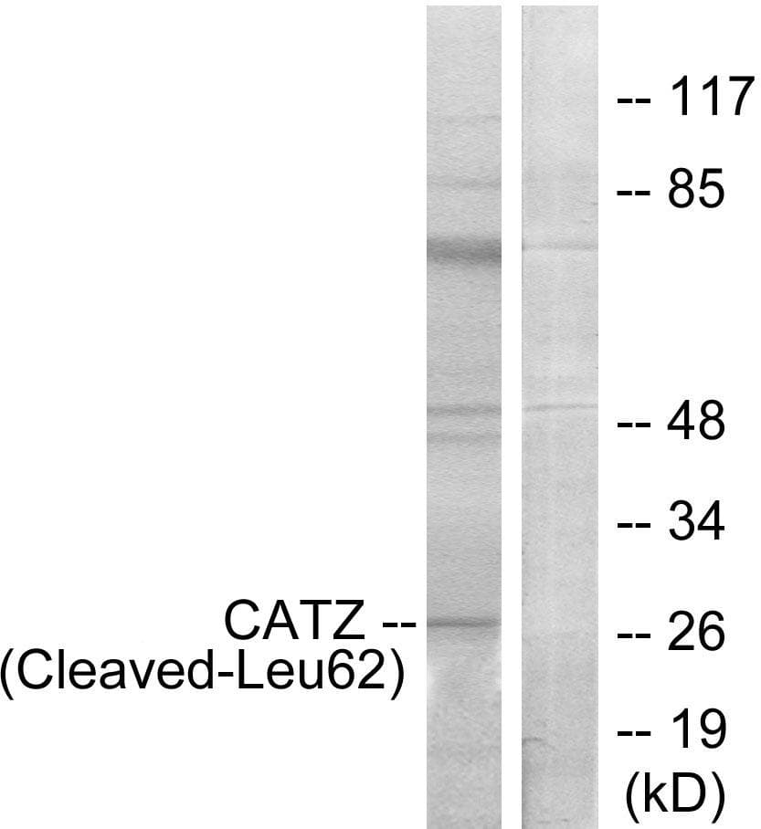 CTSZ / Cathepsin Z Antibody (Cleaved-Leu62)