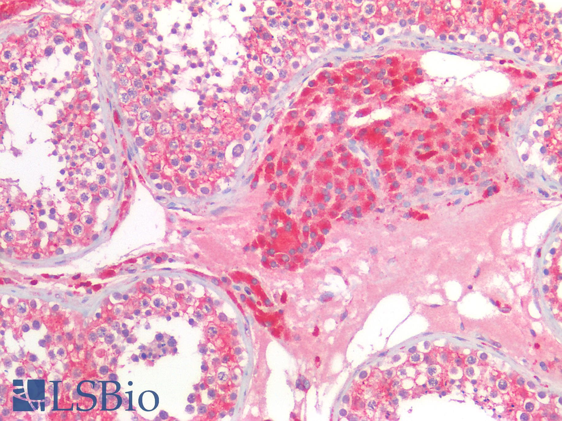 PathPlus™ Polyclonal Rabbit anti-Human HEXB Antibody (IHC)