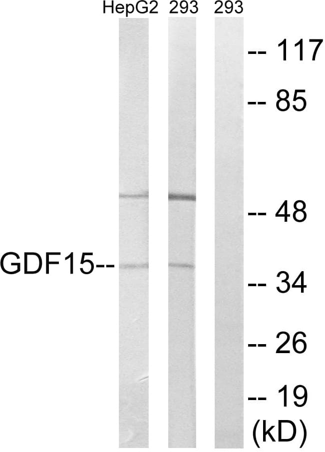 GDF15 Antibody (aa31-80)