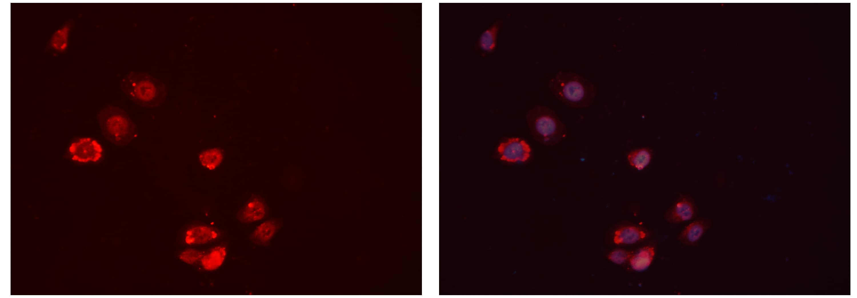 IGFBP7 / TAF Antibody