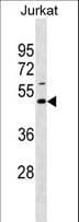 EAF1 / ELL Associated Factor 1 Antibody (aa58-85)