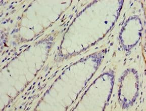 Polyclonal Rabbit anti-Human GS28 / GOSR1 / p28 Antibody (aa1-115, IHC, WB)