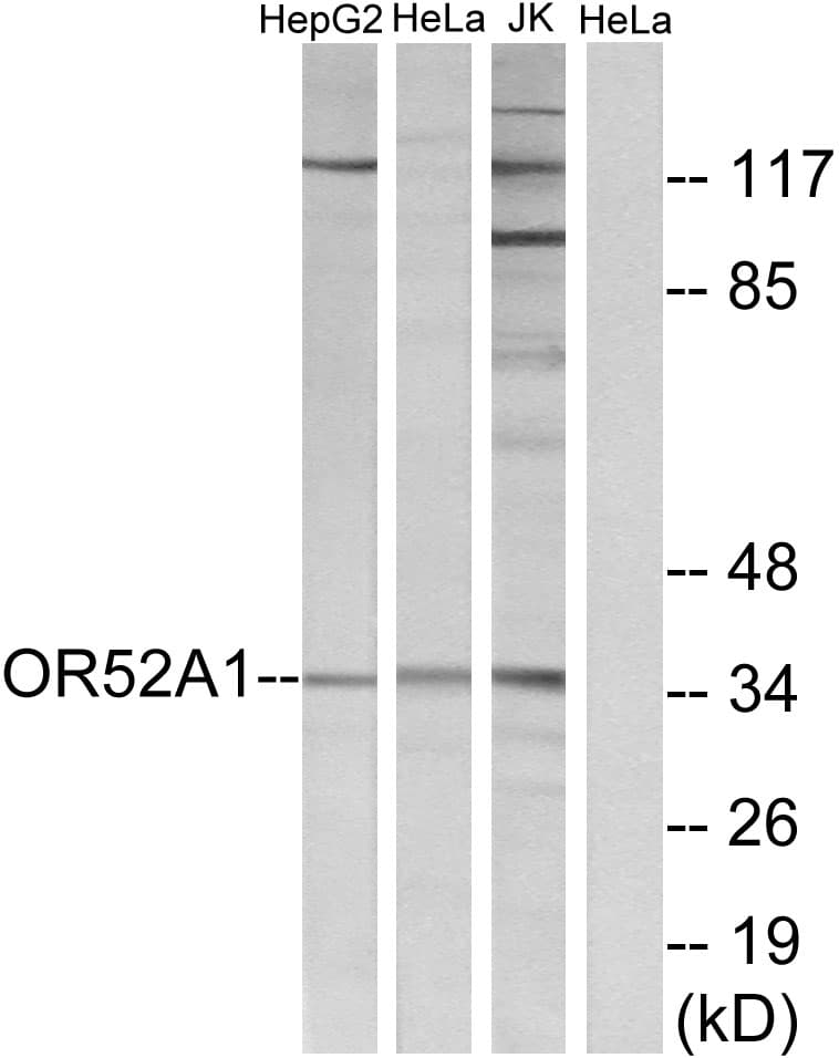 OR52A1 Antibody (aa20-69)