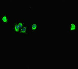 Polyclonal Rabbit anti-Human SPAG9 Antibody (IHC, IF)
