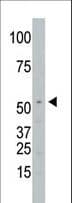 Polyclonal Rabbit anti-Human SPPL2A / IMP3 Antibody (aa108-138, IHC, WB)