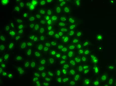 TOX Antibody