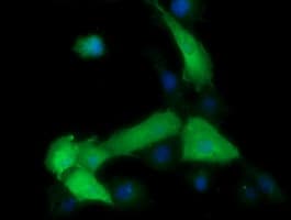 MAP2K1 / MKK1 / MEK1 Antibody (clone OTI7B1)