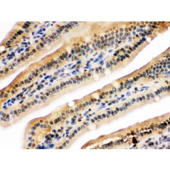 NIRF / UHRF2 Antibody (aa15-54)