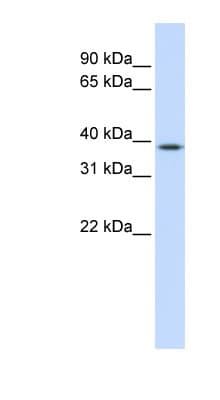 Polyclonal Rabbit anti-Human ELK3 / NET Antibody (aa180-229, WB)
