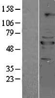 PPP2R5B Protein (Over-Expression Lysate Myc-DDK (Flag))