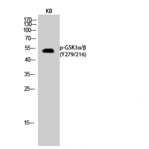 GSK3 Alpha+Beta Antibody (220-300 aa)