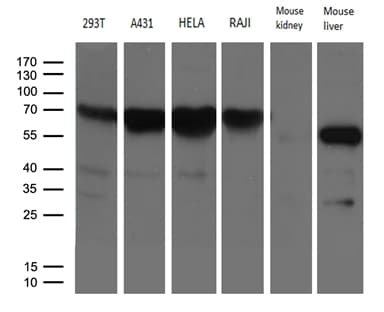 FMO3 Antibody (aa1-291, clone OTI1G4)