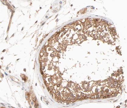 Polyclonal Rabbit anti-Human PSEN1 / Presenilin 1 Antibody (IHC, IF, WB)