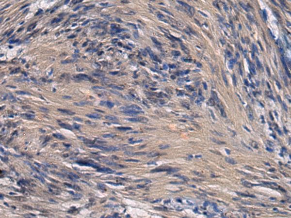 Polyclonal Rabbit anti-Human ICA69 / ICA1 Antibody (IHC)
