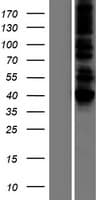 DLST / E2 Protein (Over-Expression Lysate Myc-DDK (Flag))